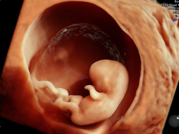 Galeria | hdlive_10_week_fetus_1.jpg