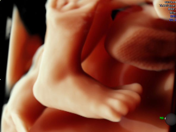 Galeria | hdlive_33_week_fetus_1.jpg